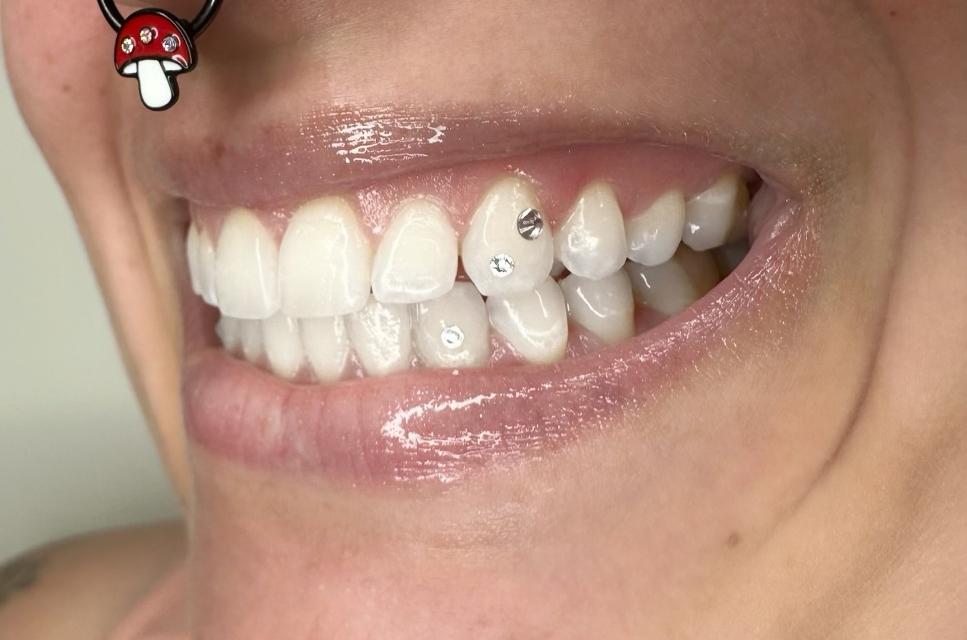 Tooth Gems Melbourne  Cosmetic Tattooing Melbourne